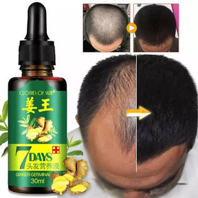 7 Days Hair Growth Germinal Serum Oil (30ml)